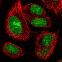 ZNF593 Antibody, Novus Biologicals:Antibodies:Primary Antibodies